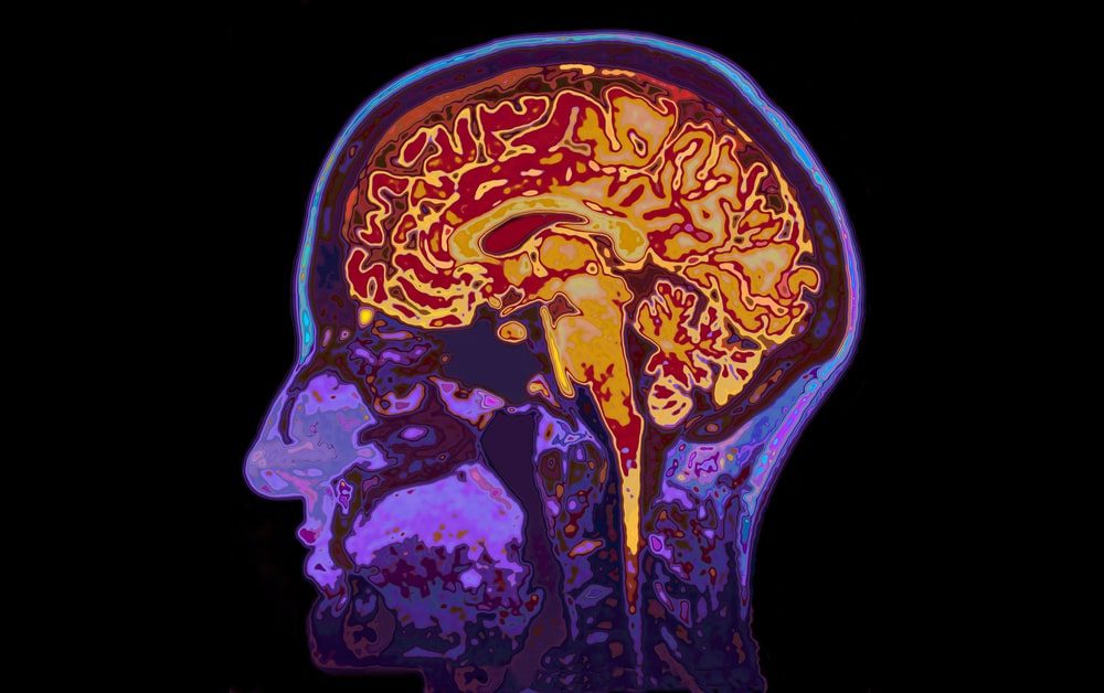 50&Più Udine organizza il convegno la salute del cervello come preservare la memoria