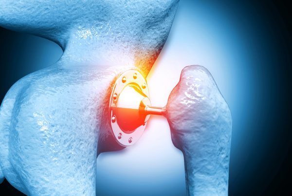 50&Più Gorizia con i Laions per il convegno sulle protesi anca e gionocchio